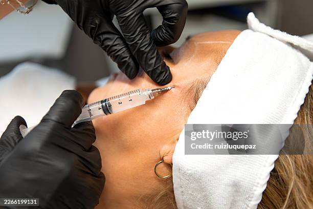 a dermatologist injecting a collagen biostimulator into her patient's face - collagen stock pictures, royalty-free photos & images