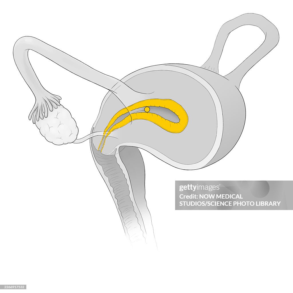 Ovum inside uterine cavity, illustration