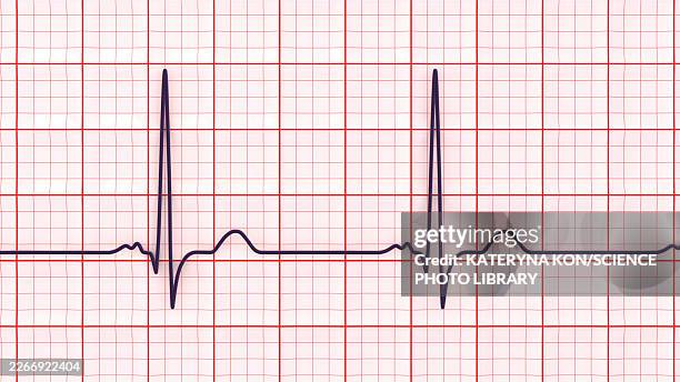 p-mitrale, illustration - pulse check stock illustrations