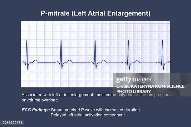 p-mitrale, illustration - pulse check stock illustrations