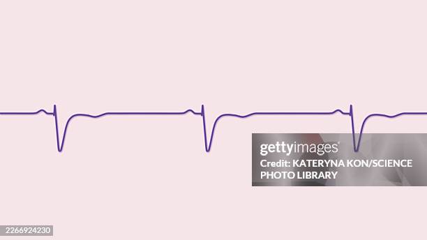normal ecg in v1-v2, illustration - standardized testing stock illustrations