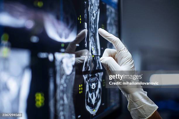 doctor reviewing medical scan on screen with gloved hand - diagnostic medical tool stock pictures, royalty-free photos & images