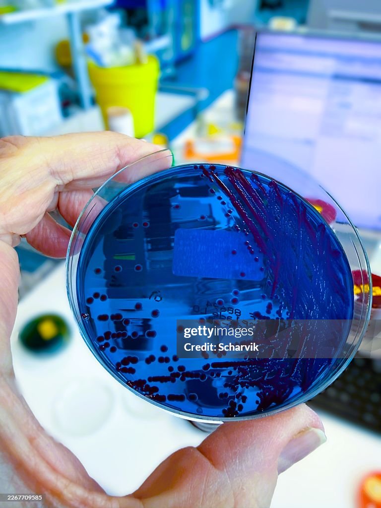 Red pigmented Serratia marcescens Bacteria Culture Close Up in Laboratory Setting