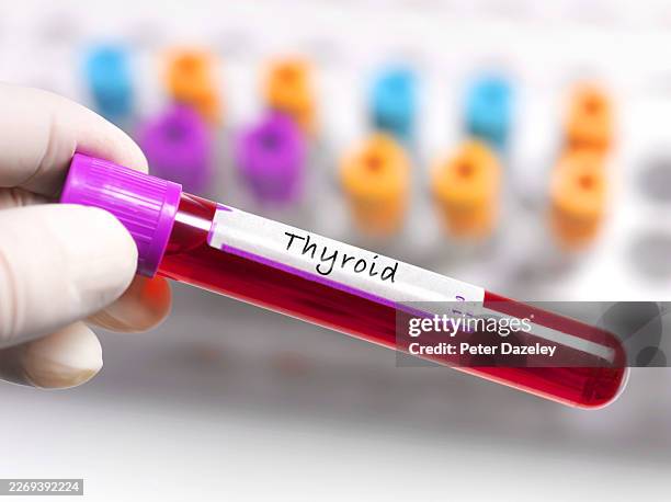 thyroid blood test. - thyroid cancer stock pictures, royalty-free photos & images