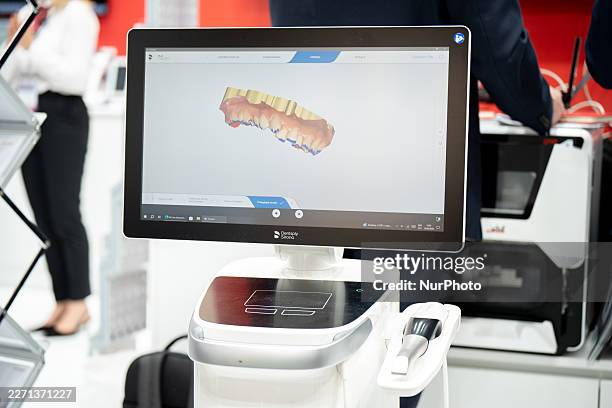 Dentsply Sirona scanner with a high-resolution 3D scan of a patient's teeth and gums is displayed during the International Dental Trade Fair Krakdent...