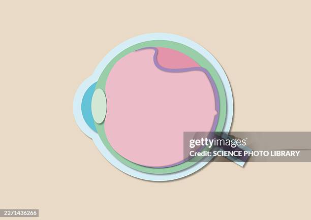 retinal detachment, illustration - retina detachment stock illustrations