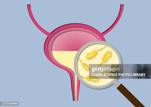 uti, conceptual illustration - urinary tract infection stock illustrations