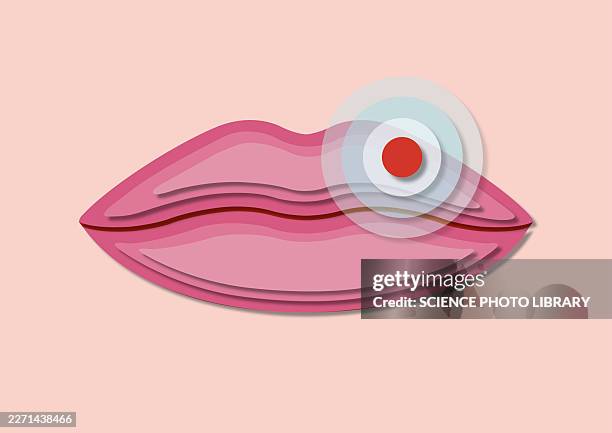 cold sore, conceptual illustration - cold sore stock illustrations
