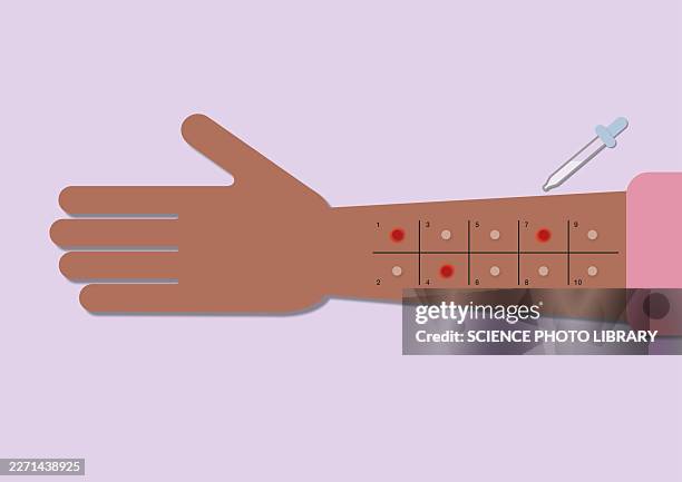 allergy testing, illustration - allergy testing stock illustrations