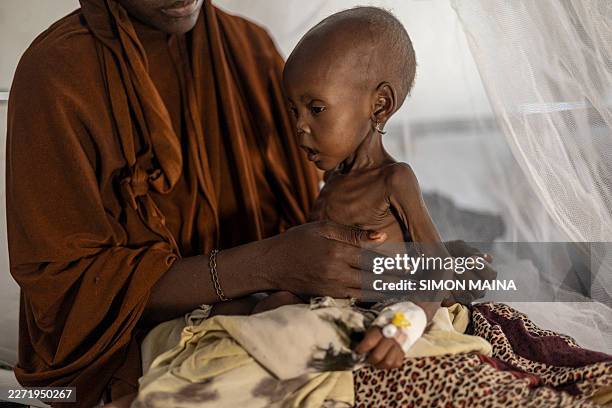Newly displaced Somali woman holds her severely malnourished baby in a stabilization centre for children suffering severe accute malnutrition in...