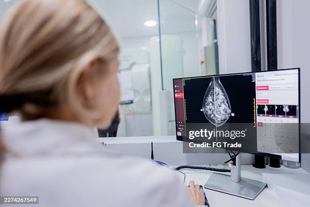 doctor examining mammography scan on hospital computer - mammogram stock pictures, royalty-free photos & images