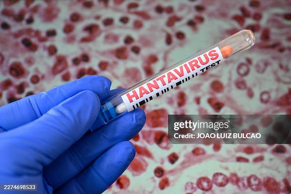 Hantavirus Testing Algorithm ILLUSTRATION of hantavirus testing concept with laboratory tubes ...