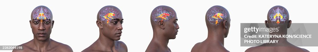 Brain ventricular system, illustration Brain ventricular system, illustration