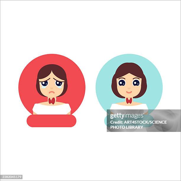 hyperthyroidism treatment, conceptual illustration - schilddrüsenüberfunktion stock-grafiken, -clipart, -cartoons und -symbole