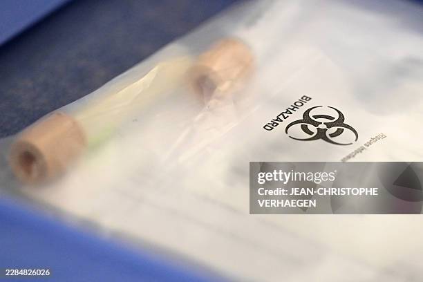 This photograph shows milk samples packed into a bag to be sent for bacteriological analysis in the pasteurisation room of the breast milk bank at...