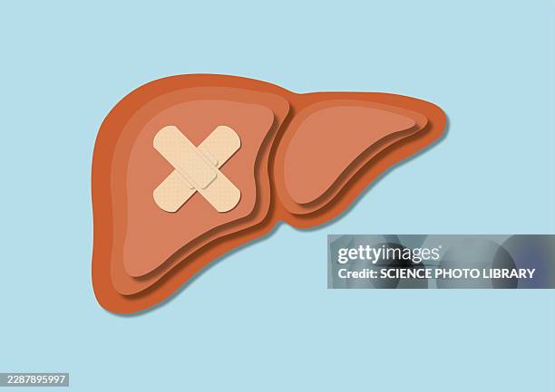 liver damage, conceptual illustration - autoimmune stock illustrations