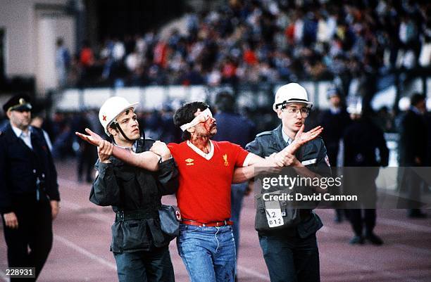 AN INJURED LIVERPOOL SOCCER FAN IS LED AWAY BY MEDICAL STAFF PRIOR TO THE 1985 EUROPEAN CUP FINAL AT THE HEYSEL STADIUM, BELGIUM. ITALIAN FANS WERE...