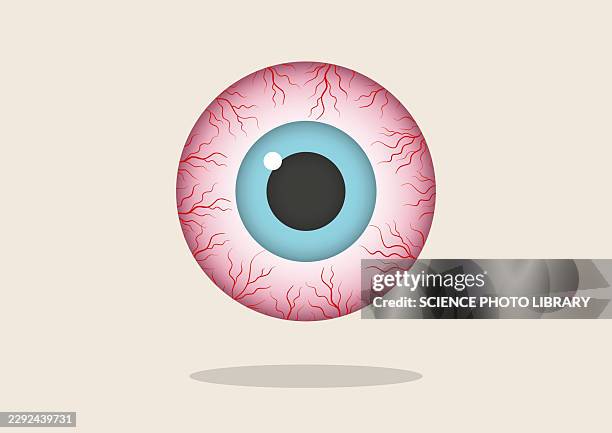 bloodshot eye, illustration - conjunctivitis stock illustrations