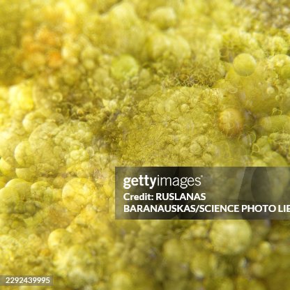 Fat cells, illustration Fat cells, illustration