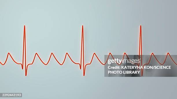 atrial flutter ecg, illustration - base line stock illustrations