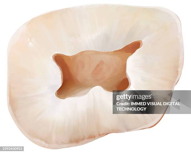 upper first molar wide flat pulp floor, illustration - dentin stock illustrations