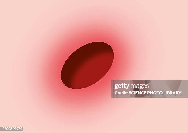 ulcer, conceptual illustration - ulcer stock illustrations