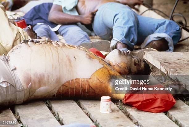 Image depicts death.) JONESTOWN, GUYANA The Reverend Jim Jones' bloated body lies on the ground after it was hastily sewn together after his autopsy...