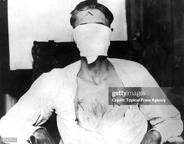 Nelson Burroughs who was kidnapped by members of the American white supremacist movement, the Ku Klux Klan and branded with hot irons because he...