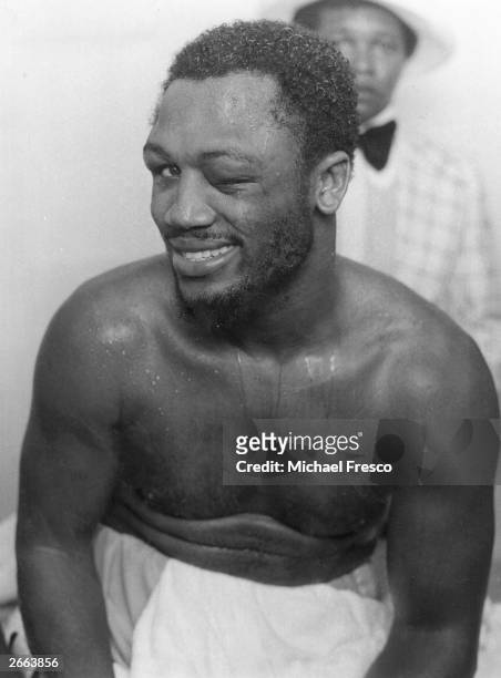 American boxer Joe Frazier with a swollen eye after a world title fight.