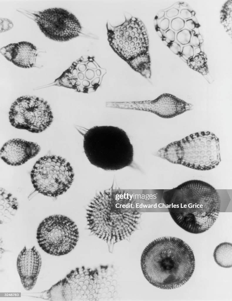 Various amoeboid protozoans, a type of plankton, seen under Xray