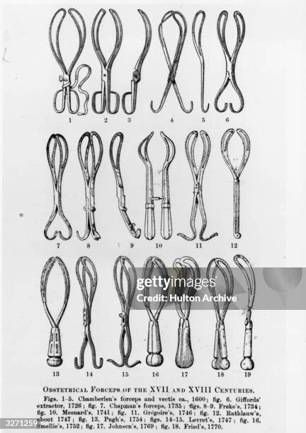 Obstetrical forceps of the 17th and 18th centuries.