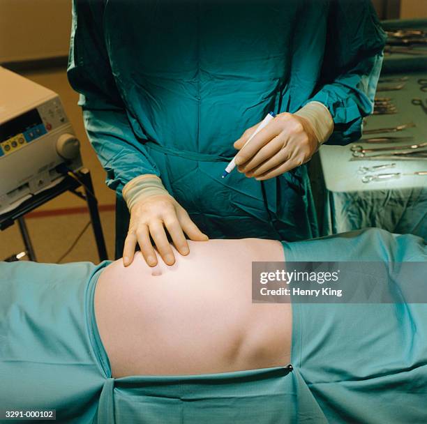 surgeon and patient - plastic surgeon stock pictures, royalty-free photos & images