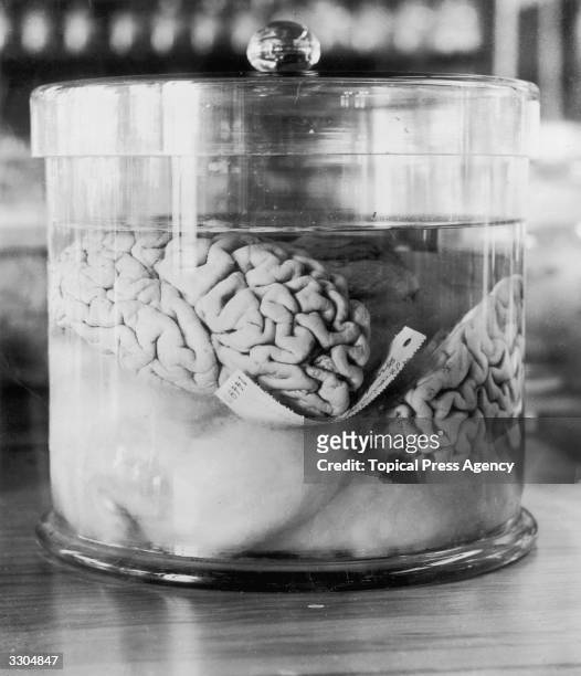 The pickled brain of a burglar by the name of Dunlap.