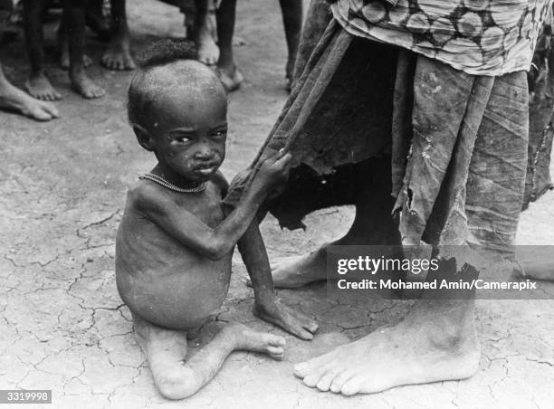 Starving Somali child tugs at the ragged skirt of his nomad mother in one of the camps set up for the refugees of the three year drought in...