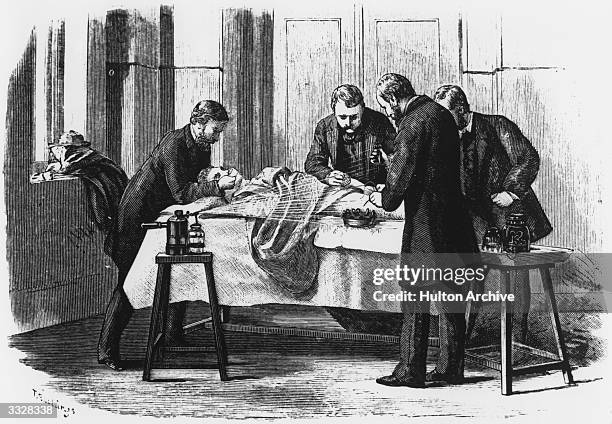 Cloth covered in chloroform is being held over the patient's face and carbolic spray worked by a steam apparatus is creating an antiseptic...