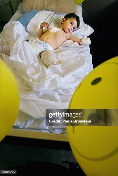 Ali Nassar Fadil, 4 years old, lies in a ward at the Italian Red Cross hospital, on April 13, 2004 after loosing his left arm and leg 5 days ago from...