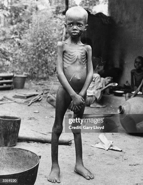 A Starving Child In A Nigerian Refugee Camp News Photo Getty Images a-starving-child-in-a-nigerian-refugee-camp-news-photo-getty-images