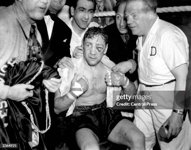 American heavyweight boxer Gus Lesnevich nurses a black eye after winning the championship fight against Freddie Mills in Harringay, London.