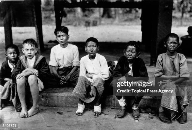 Leper at the Leper colony, Rangoon, Burma .