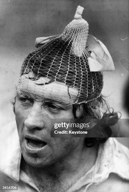 Italian Rugby player A Bollesan wears an odd looking piece of head protection, as Italy meet the French B team in Rome.