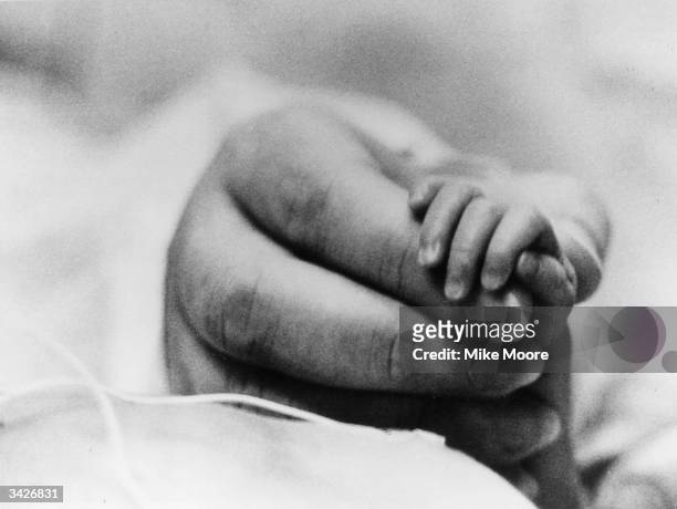 Close-up of premature baby Linda Lawrence holding the hand of her mother Maureen. She was 9 weeks premature and is now 3 days old and weighs 3lb 90z.