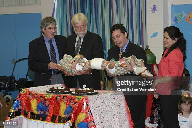 Conjoined twins Clarence and Carl Aguirre are held by their doctors Dr. Robert Marion, Dr. James T. Goodrich and Dr. David Staffenberg, along with...