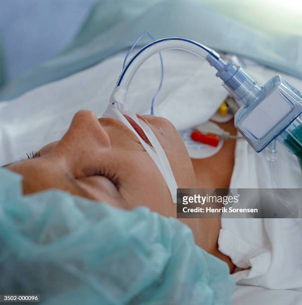 patient breathing through tube - équipement d'assistance respiratoire photos et images de collection