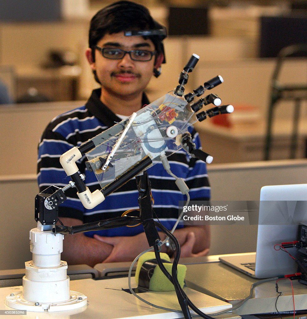 Boy Wins Award For Bluetooth Controleld Prosthetic Hand