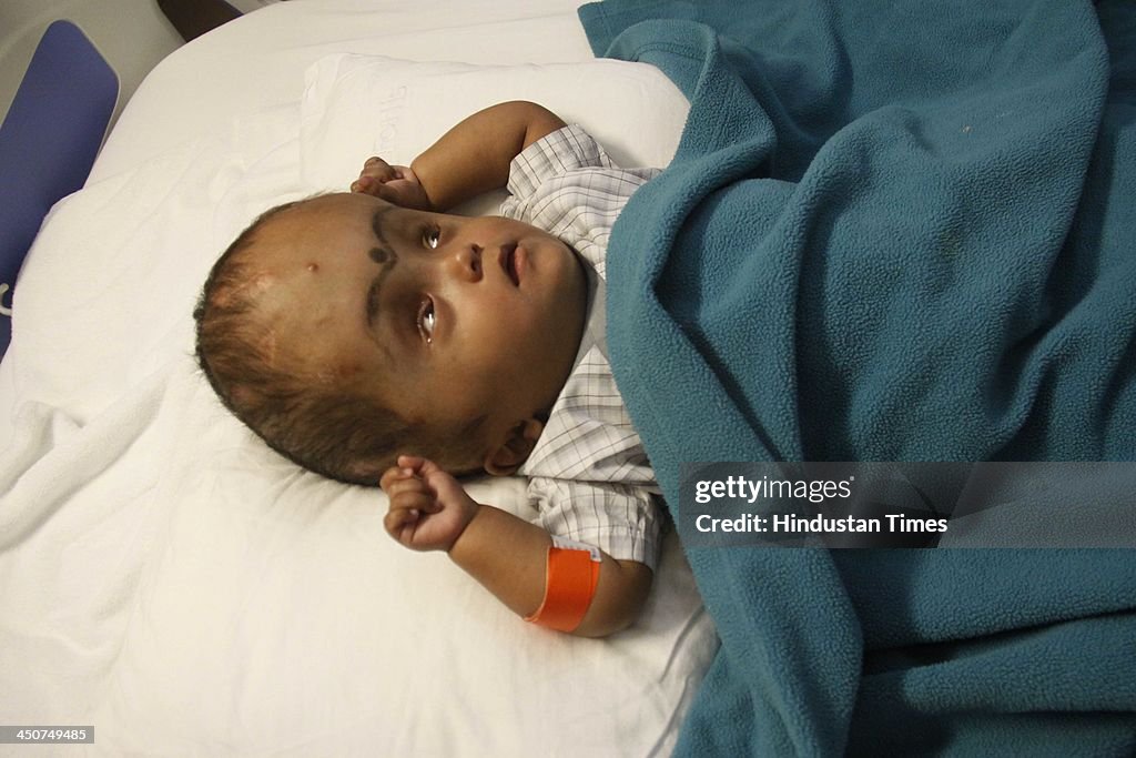 Roona Begum, two-year-old miracle baby who recently underwent a rare