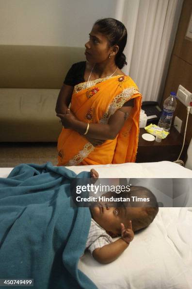 Baby Roona Roona Begum, two-year-old miracle baby who recently underwent a rare ...