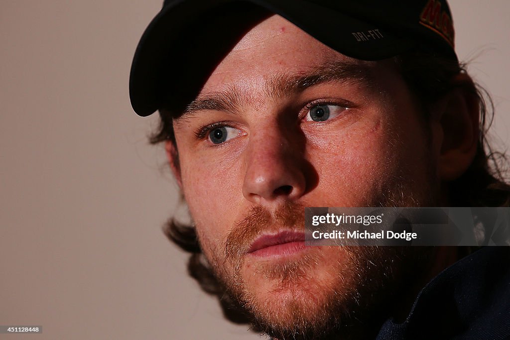 Carlton Blues Press Conference