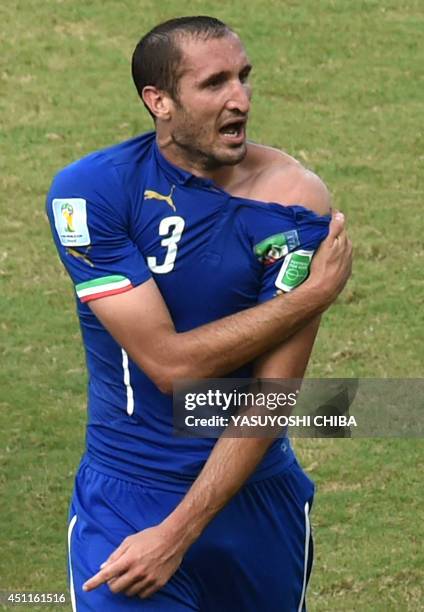 Italy's defender Giorgio Chiellini shows an apparent bitemark by Uruguay forward Luis Suarez during a Group D football match between Italy and...
