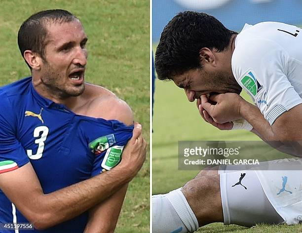 This combo of 2 photos shows Italy's defender Giorgio Chiellini showing an apparent bitemark and Uruguay forward Luis Suarez holding his teeth after...