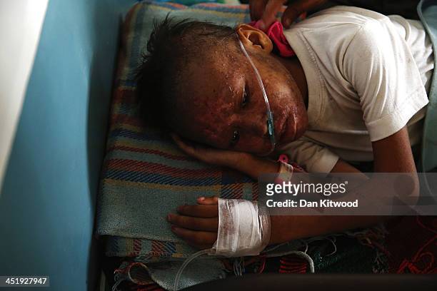 An injured child lies in a bed in the children's and maternity ward at the Eastern Visayas Medical Centre in Tacloban on November 20, 2013 in Leyte,...